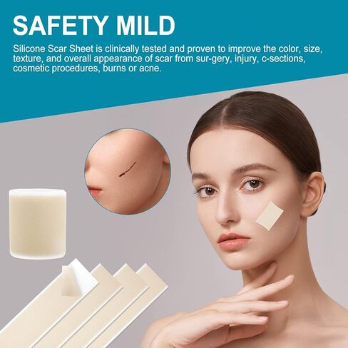 Silicone Scar Sheets - Scar Away Tape Roll (1.6" x 120"Roll) Silicone Strips, Reusable, Professional Scar Removal Sheets for C-Section, Surgery, Burn, Keloid, Acne in Kuwait