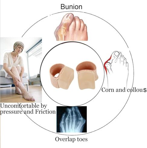 فواصل جل لأصابع القدم من 6 قطع، مصحح ورم ابهام القدم المتداخلة، فواصل اصابع القدم من السيليكون مع بطانة جل ناعمة لتخفيف الام ابهام القدم والورم (مقاس L) in Kuwait