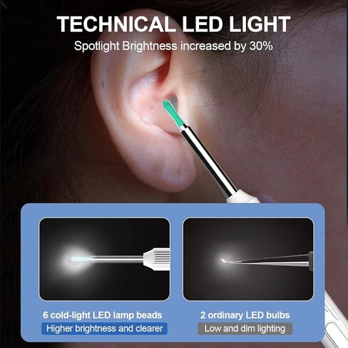 إزالة شمع الأذن من فيرنيش، منظف الأذن مع الكاميرا، مجموعة تنظيف الأذن بإضاءة لاسلكية قابلة لإعادة الشحن، مجموعة تنظيف الأذن لهواتف iPhone وiPad وهواتف Android (أبيض) in Kuwait