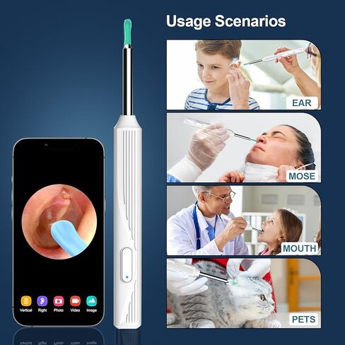 إزالة شمع الأذن من فيرنيش، منظف الأذن مع الكاميرا، مجموعة تنظيف الأذن بإضاءة لاسلكية قابلة لإعادة الشحن، مجموعة تنظيف الأذن لهواتف iPhone وiPad وهواتف Android (أبيض) in Kuwait