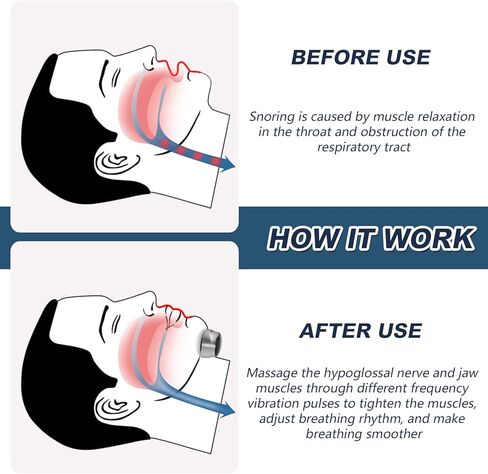 جهاز مضاد للشخير، أجهزة كهربائية مطورة لسداد الشخير مع تدليك ذكي للحلق، آلة حل الشخير من أجل نوم أفضل in Kuwait