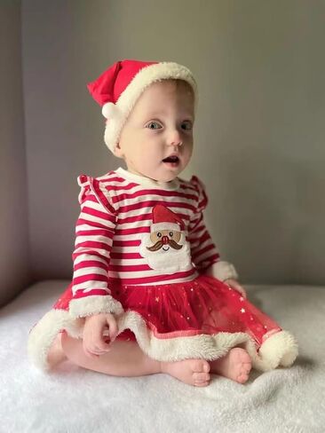 VINUOKER ملابس عيد الميلاد الأولى للفتيات حديثي الولادة من VINUOKER، فستان Xmax للفتيات الرضع، ملابس عيد الميلاد للفتيات الصغيرات ملابس سانتا للأطفال in Kuwait