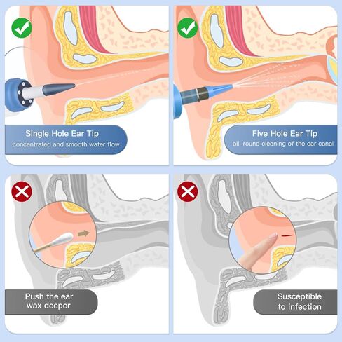 Ear Wax Removal, JOKARWAY Ear Cleaner, Ear Wax Removal Tool with 5 Lights, 4 Pressure Modes Ear Washer, Ear Irrigation Flushing System for Humans Kids 9+1 Ear Tips in Saudi Arabia