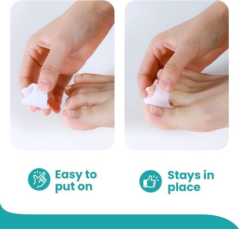 جهاز تمليس أصابع القدم المطرقة من بروميفون - جبائر أصابع القدم - أداة تمليس أصابع القدم لإعادة تنظيم الانحناء والتجعيد والاعوج والمخلب وأصابع القدم المطرقة وإعادة تنظيم الانحناء، 3 مقاسات مختلفة للنساء والرجال (أبيض) in Kuwait