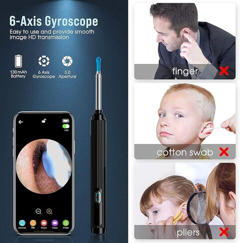 أداة إزالة شمع الأذن بالكاميرا لإزالة شمع الأذن - أداة إزالة شمع الأذن مع مجموعة 8 قطع للأذن - مجموعة إزالة شمع الأذن مع ضوء - منظف الأذن مع الكاميرا - منظف الأذن لأجهزة Android وiOS (أسود-B) in Kuwait