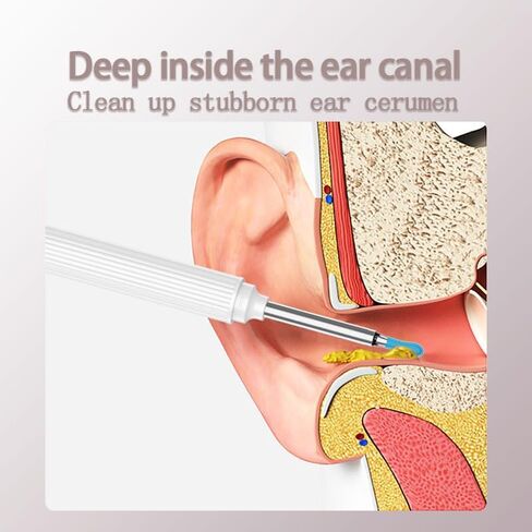 أداة إزالة شمع الأذن بالكاميرا لإزالة شمع الأذن - أداة إزالة شمع الأذن مع مجموعة 8 قطع للأذن - مجموعة إزالة شمع الأذن مع ضوء - منظف الأذن مع الكاميرا - منظف الأذن لأجهزة Android وiOS (أسود-B) in Kuwait