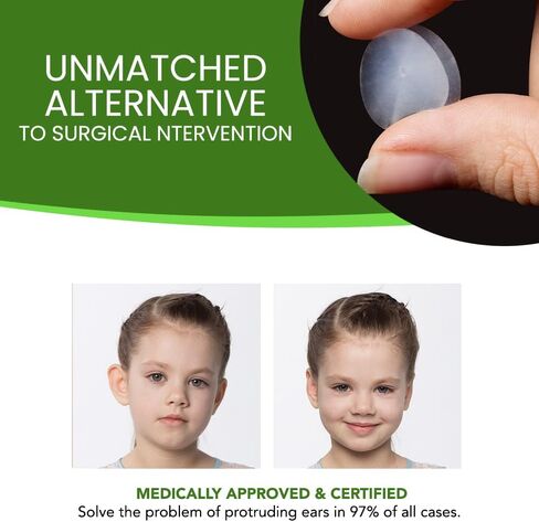 Pretty Ears Cosmetic Ear Correctors for Children (4 Pairs) – Transparent Medical Grade Silicone Ear Tape for Prominent Ears - Correct Protruding Ears Without Surgery for Toddlers, Kids in Kuwait
