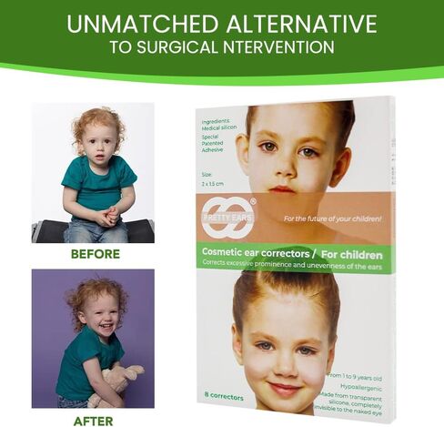Pretty Ears Cosmetic Ear Correctors for Children (4 Pairs) – Transparent Medical Grade Silicone Ear Tape for Prominent Ears - Correct Protruding Ears Without Surgery for Toddlers, Kids in Kuwait