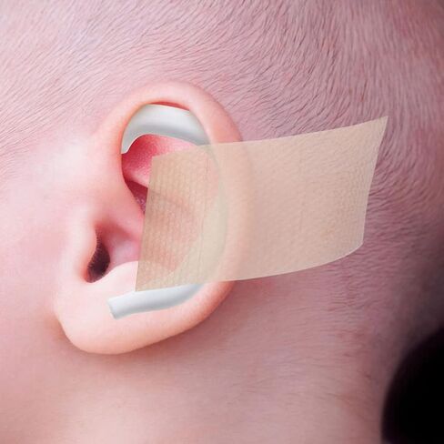 EXCEART Ear Corrector Baby Ear Aesthetic Corrector, 6 Pairs Infant Ear Corrector Auricle Valgus Correction Ear Correction Support Accessories for Kids Children Orthopaedic Ear Ear Caps in Saudi Arabia