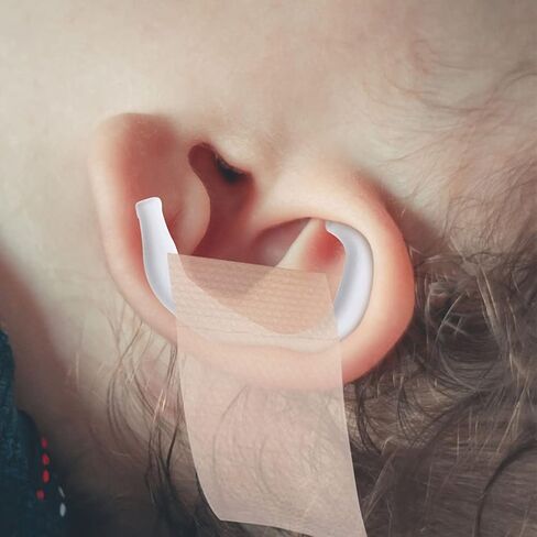 EXCEART Ear Corrector Baby Ear Aesthetic Corrector, 6 Pairs Infant Ear Corrector Auricle Valgus Correction Ear Correction Support Accessories for Kids Children Orthopaedic Ear Ear Caps in Saudi Arabia