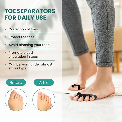 Welnove 8 Pack - Toe Separators - Small Size Toe Straightener for Correct Toe Alignment - Toe Spacers for Women（Black*8） in Kuwait