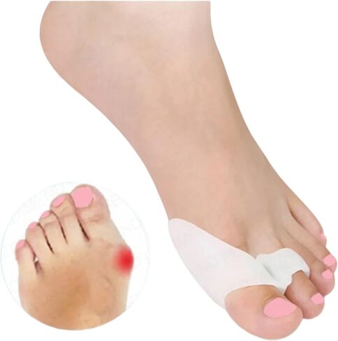 اكستريم مجموعة وسادات ورم ابهام القدم الرياضية مكونة من قطعتين - زوج واحد من وسائد الجل الناعمة - مقاس واحد يناسب الجميع - تخفيف سريع - للارتداء مع الاحذية - للرجال والنساء in Kuwait