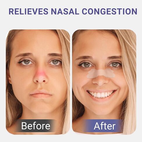 شرائط الأنف الشفافة من كونكوت، تخفيف احتقان الأنف الناجم عن أعراض البرد أو الحساسية أو النوم المضطرب، شرائط الأنف الخالية من الأدوية لتقليل الشخير، 30 قطعة in Kuwait