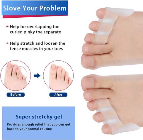 مصحح ورم إبهام القدم، فاصل أصابع القدم بينكي جل سيليكون ناعم واقي أصابع القدم من أجل مسامير القدم والبثور ومسامير القدم وتخفيف الآلام وفصل أصابع القدم يناسب الرجال والنساء in Kuwait