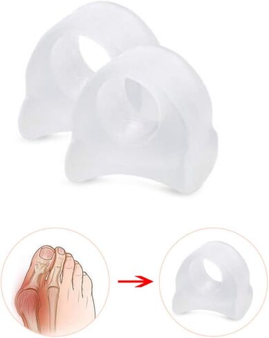 10 قطع من واقيات أصابع القدم وفواصل أصابع القدم، مصحح إبهام القدم، فاصل أصابع القدم الكبيرة لتصحيح إبهام القدم الكبيرة، أصابع متداخلة، أصابع مطرقة - (شفاف) in Kuwait