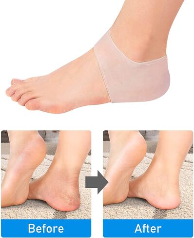 أكواب الكعب من Pinkiou لتخفيف الألم من جل السيليكون للكعب للنساء والرجال، واقيات الكعب زوج واحد مرطب لالتهاب اللفافة الأخمصية والبثور والقدم المتشققة in Kuwait