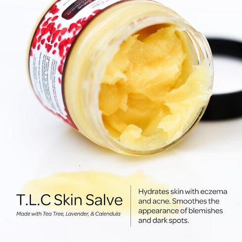 Red Rose Naturals TLC Skin Salve Non-Petroleum Ointment | 100% All Natural Balm with Calendula | Eczema Cream, Psoriasis, Acne, Blemishes, Dark Spots, Rashes, Dry Skin in Saudi Arabia