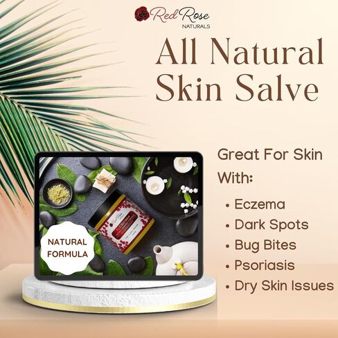 Red Rose Naturals TLC Skin Salve Non-Petroleum Ointment | 100% All Natural Balm with Calendula | Eczema Cream, Psoriasis, Acne, Blemishes, Dark Spots, Rashes, Dry Skin in Saudi Arabia