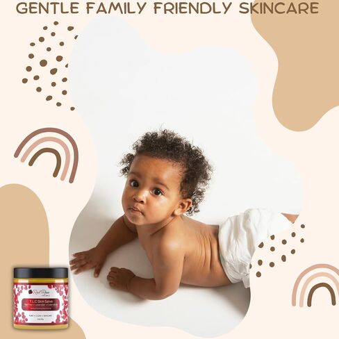 Red Rose Naturals TLC Skin Salve Non-Petroleum Ointment | 100% All Natural Balm with Calendula | Eczema Cream, Psoriasis, Acne, Blemishes, Dark Spots, Rashes, Dry Skin in Saudi Arabia