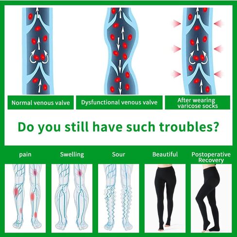 جوارب ضغط VARCOH للنساء، سراويل ضيقة ضاغطة للنساء، جوارب ضغط طبية مناسبة لجلطات الأوردة العميقة، والحمل، والدوالي، وجبائر الساق المريحة، والوذمة in Kuwait
