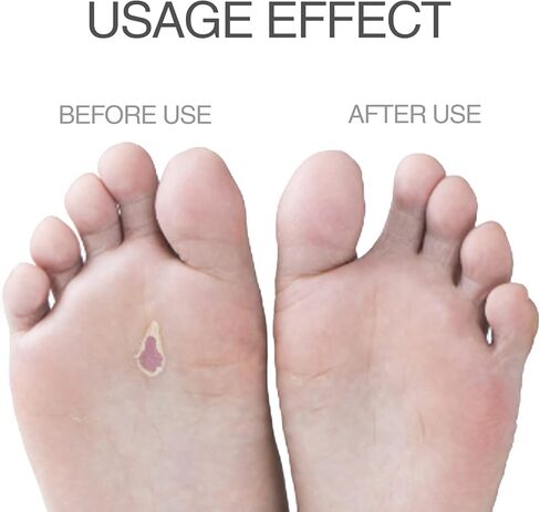 12 حزمة من وسادات إدخال أقدام مشط القدم ووسادة كرة القدم لتخفيف آلام مقدمة القدم ودعم القدم الإسفنجية اللاصقة، ورم عصبي مشط القدم، وسادة وسادة للرجال والنساء بسمك 1/4 بوصة (أبيض) in Kuwait