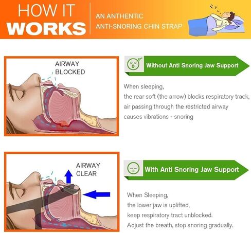 حزام الذقن المضاد للشخير، أشرطة الذقن لوقف الشخير لمستخدمي CPAP، حزام الفك للنوم، أشرطة الذقن لإبقاء الفم مغلقًا للنوم بشكل أفضل، حزام الذقن Cpap للنوم للرجال والنساء in Kuwait