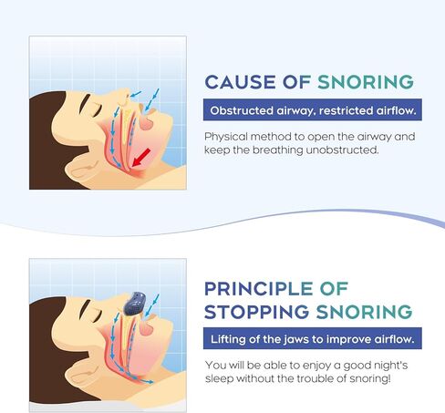 Anti Snoring Devices,snoring Solution,Effective Snoring Prevention, Adjustable and Breathable,Snoring Solution for Men and Women,Suitable for All Nose Shapes.blue-02 in Kuwait