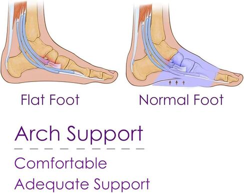 Arch Support Bands Built-in Orthotics for Plantar Fasciitis Pain Relief,Arch Support Sleeves With Gel Pad Inside,Flat Feet Support,Foot Pain Relief,Fallen Arches,Achy Feet Problems for Men and Women in Kuwait