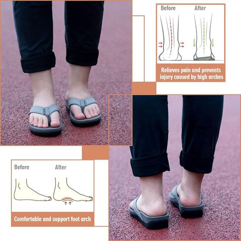 صنادل Everhealth Orthotic Flip Flop Thongs للنساء لدعم قوس القدم لالتهاب اللفافة الأخمصية وتخفيف آلام الكعب المسطحة، فائقة النعومة ممتصة للصدمات ومقاومة للانزلاق، صنادل الشاطئ بأصابع القدم in Kuwait
