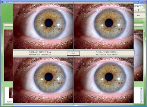 كاميرا آيريدولوجي بدقة عالية 12 ميجابكسل بتقنية يو إس بي آيريسكوب مع عدسة قزحية عالية الدقة 12 ميجابكسل وبرمجيات تحليل خالية من السائقين (النسخة الإنجليزية والإسبانية) in Kuwait