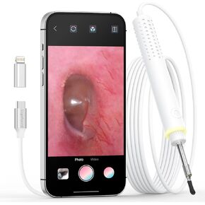 ScopeAround Otoscope for iPhone, 3.9mm Ultra-Thin Ear Camera with 6 LED Lights, Ear Scope with Ear Wax Removal Tool Camera,USB Ear Cleaning Camera Compatible with iPhone/Android (No WiFi Needed) in Kuwait