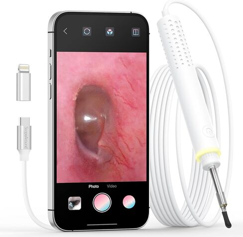 ScopeAround Otoscope for iPhone, 3.9mm Ultra-Thin Ear Camera with 6 LED Lights, Ear Scope with Ear Wax Removal Tool Camera,USB Ear Cleaning Camera Compatible with iPhone/Android (No WiFi Needed) in Kuwait