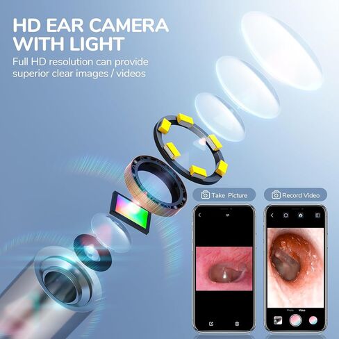 ScopeAround Otoscope for iPhone, 3.9mm Ultra-Thin Ear Camera with 6 LED Lights, Ear Scope with Ear Wax Removal Tool Camera,USB Ear Cleaning Camera Compatible with iPhone/Android (No WiFi Needed) in Kuwait