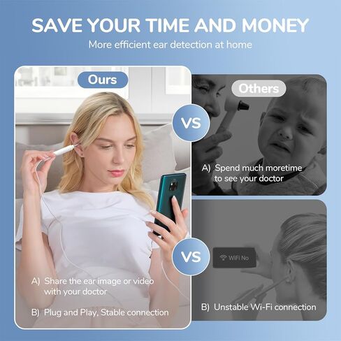 ScopeAround Otoscope for iPhone, 3.9mm Ultra-Thin Ear Camera with 6 LED Lights, Ear Scope with Ear Wax Removal Tool Camera,USB Ear Cleaning Camera Compatible with iPhone/Android (No WiFi Needed) in Kuwait