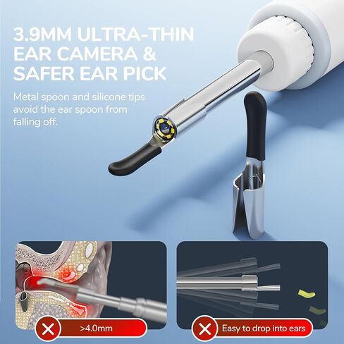 ScopeAround Otoscope for iPhone, 3.9mm Ultra-Thin Ear Camera with 6 LED Lights, Ear Scope with Ear Wax Removal Tool Camera,USB Ear Cleaning Camera Compatible with iPhone/Android (No WiFi Needed) in Kuwait