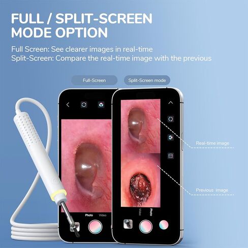 ScopeAround Otoscope for iPhone, 3.9mm Ultra-Thin Ear Camera with 6 LED Lights, Ear Scope with Ear Wax Removal Tool Camera,USB Ear Cleaning Camera Compatible with iPhone/Android (No WiFi Needed) in Kuwait