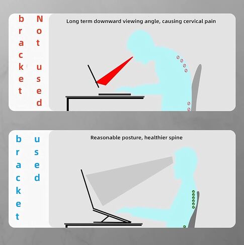 zgyad Desktop Laptop Stand, Multi Angle Adjustable Aluminum Laptop Stand, Ergonomic Laptop Stand, Fully Covered with Silicone Protection, Compatible with 10 to 15.6 inch laptops (Silvery) in Kuwait