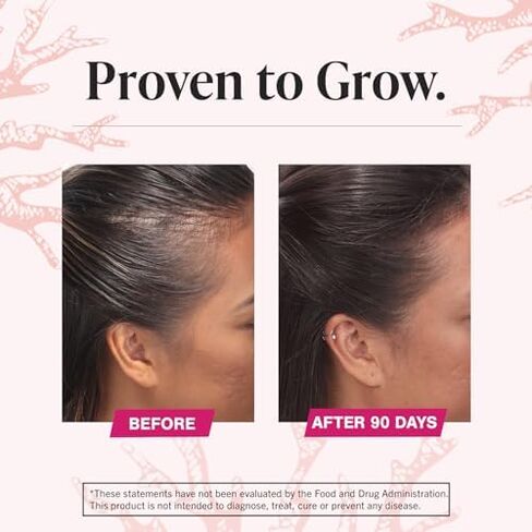 Viviscal Hair Growth Supplements for Women to Grow Thicker, Fuller Hair, Clinically Proven with Proprietary Collagen Complex, 60 Count (Pack of 1), 1 Month Supply in Saudi Arabia