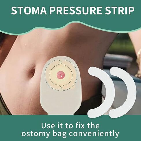 Hydrocolloid Skin Barrier Strips, Waterproof Medical-Grade Barrier Strips, Leak-Proof Seal Extenders for Colostomy Stoma Bags – Universal, Works for All Bag Type, Ostomy Suppliess – 20 Count in Kuwait