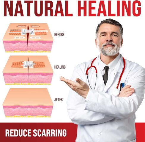 Emergency Wound Closure Strips - 2pk - Laceration Closure Kit - Stitchless & Easy to Use - Butterfly Bandages in Kuwait