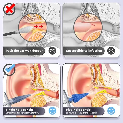 Ear Wax Removal, Manual Ear Irrigation Flushing System, Ear Wax Removal Tool, Safe and Effective Ear Cleaning Kit, Ear Cleaner - Includes Basin,10 Tips in Kuwait