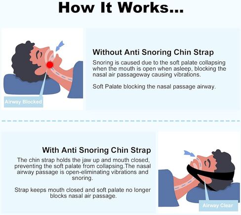 حزام ذقن للشخير لمستخدمي CPAP، أجهزة مضادة للشخير، حزام ذقن قابل للتعديل للشخير، حل فعال للشخير لوقف الشخير، حزام ذقن للنوم مسامي للرجال والنساء in Kuwait