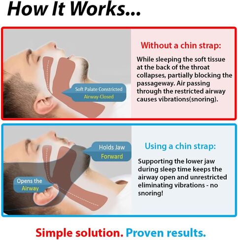 Premium Anti Snore Chin Strap by ZARU [New Version] - Advanced Snoring Solution Scientifically Designed to Stop Snoring Naturally and Give You a Good Night's Sleep in Kuwait