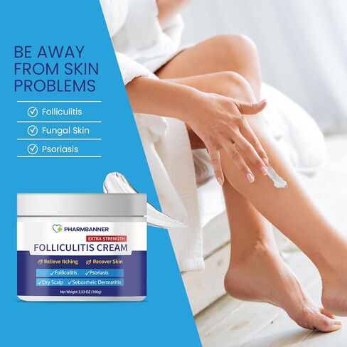 كريم علاج التهاب الجريبات، علاج قوي لالتهاب الجريبات لفروة الرأس، كريم مضاد للفطريات، كريم الصدفية، علاج فعال سريع لالتهاب الجريبات، الصدفية والتهاب الجلد الدهني، تخفيف الحكة in Kuwait