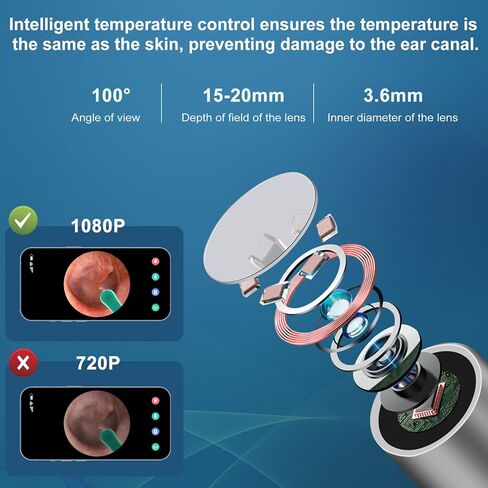 أداة إزالة شمع الأذن، منظف الأذن مع كاميرا منظار الأذن بدقة 1080 بكسل عالية الدقة، واي فاي مدمج، مجموعة تنظيف الأذن لهواتف iPhone وAndroid - أسود in Kuwait