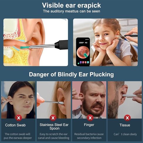 أداة إزالة شمع الأذن، منظف الأذن مع كاميرا منظار الأذن بدقة 1080 بكسل عالية الدقة، واي فاي مدمج، مجموعة تنظيف الأذن لهواتف iPhone وAndroid - أسود in Kuwait