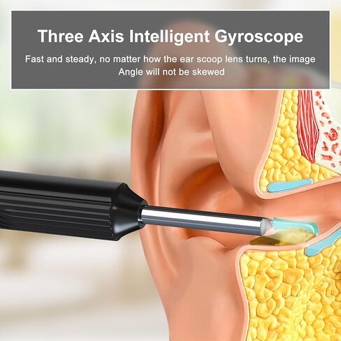 أداة إزالة شمع الأذن، منظف الأذن مع كاميرا منظار الأذن بدقة 1080 بكسل عالية الدقة، واي فاي مدمج، مجموعة تنظيف الأذن لهواتف iPhone وAndroid - أسود in Kuwait