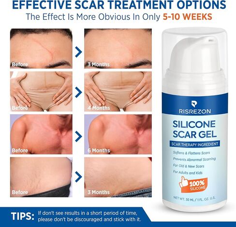 جل إزالة الندبات السيليكون من ريسريزون: كريم متطور لإصلاح الندبات لجسم الوجه - علاج طبي للندبات الجراحية وعلامات التمدد وحرق الجدرة وإصابات شد البطن وندبات حب الشباب 1.06 جم in Kuwait