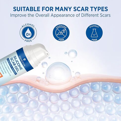 جل إزالة الندبات السيليكون من ريسريزون: كريم متطور لإصلاح الندبات لجسم الوجه - علاج طبي للندبات الجراحية وعلامات التمدد وحرق الجدرة وإصابات شد البطن وندبات حب الشباب 1.06 جم in Kuwait