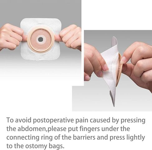 15+6 قطع من اكياس فغر القولون، لوازم فغر القولون، كيس فغر من قطعة واحدة قابل للتصريف للعناية بفغر اللفائف، مقصوصة لتناسب in Kuwait